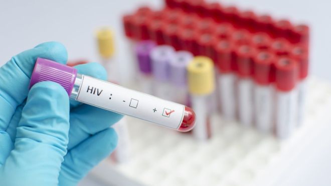 asomadetodosafetos.com - Vacina contra o HIV começará testes em humanos no final de 2019