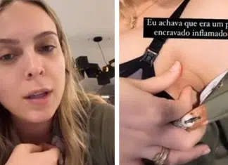 Influencer descobre mamilo na axila: “Se apertar, sai leite”