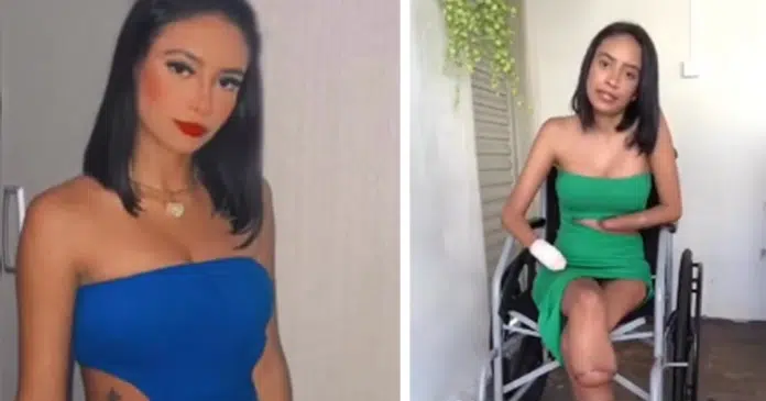 Jovem que teve membros amputados devido à infecção urinária conta sua história em vídeo