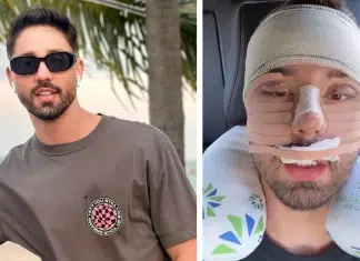 Influenciador Rico desabafa após novas cirurgias: “Padrão que a sociedade pede”