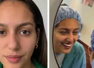 Jovem brasileira faz cirurgia para trocar a cor dos olhos. Saiba mais