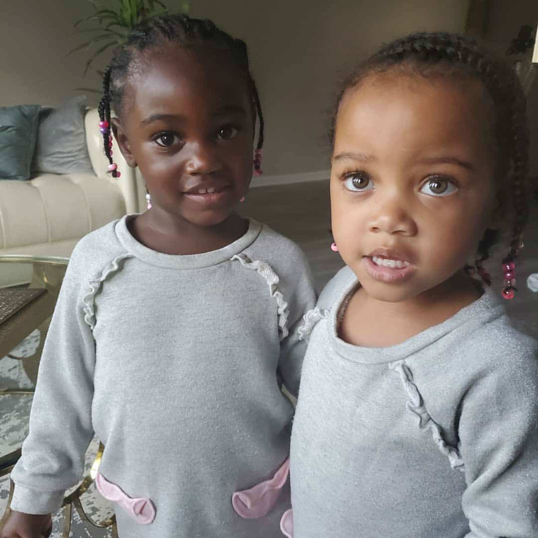 asomadetodosafetos.com - Saiba como é possível essas gêmeas terem nascido com cores de pele diferentes
