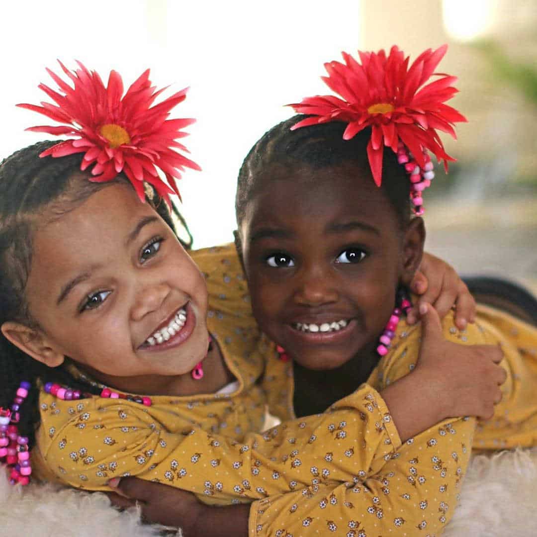asomadetodosafetos.com - Saiba como é possível essas gêmeas terem nascido com cores de pele diferentes