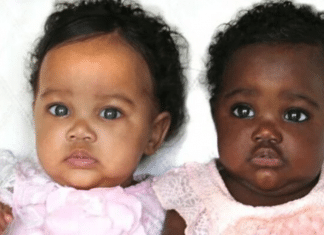 Saiba como é possível essas gêmeas terem nascido com cores de pele diferentes